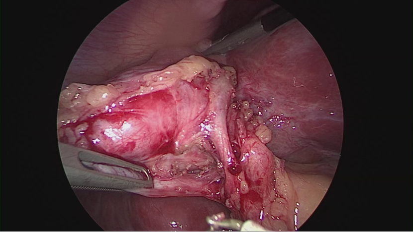 Tissue Localization